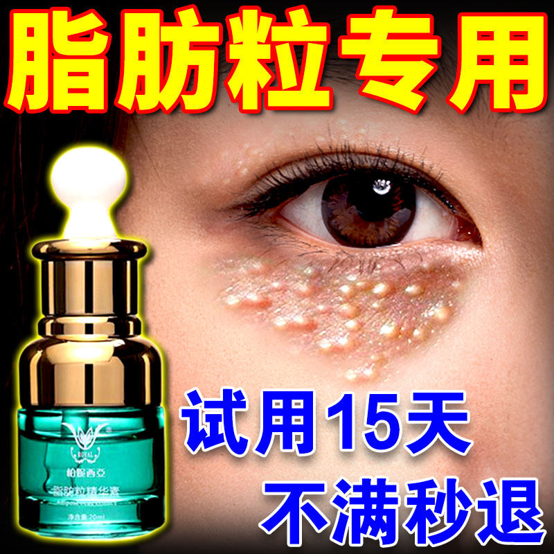 脂肪粒汗管粒眼部去除神器专用药膏祛眼周颗粒油脂粒脸部消除眼霜