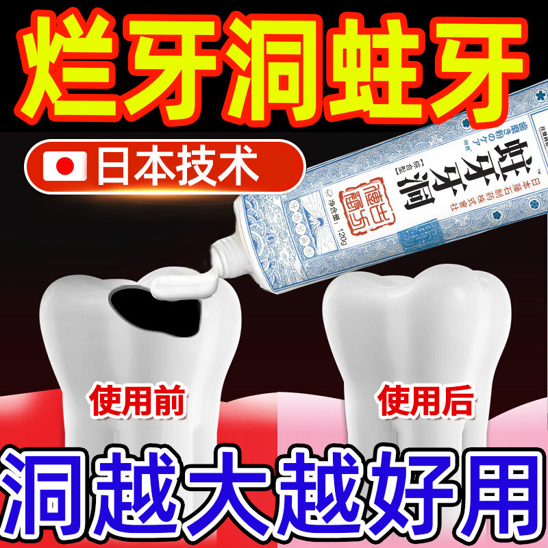 牙膏防蛀抗敏含氟牙周炎口腔治补牙缝龋齿牙缝宽大修复神器成人LL