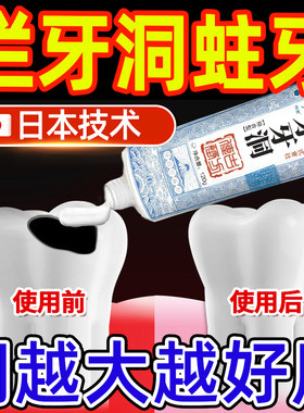 牙膏防蛀抗敏含氟牙周炎口腔治补牙缝龋齿牙缝宽大修复神器成人LL