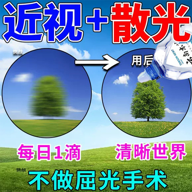 盐酸奈甲唑咻滴眼液磺胺醋酸钠眼药水缓解视疲劳珍视明视力青少年