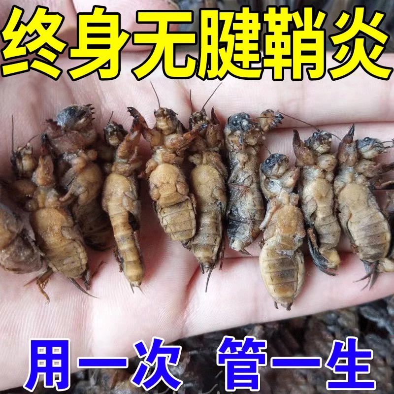 腱鞘炎手指关节疼痛腱鞘焱消除