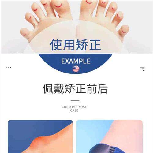 锤头状趾矫正器爪状弯曲重叠下垂上翘脚趾骨折固定食指中指小指