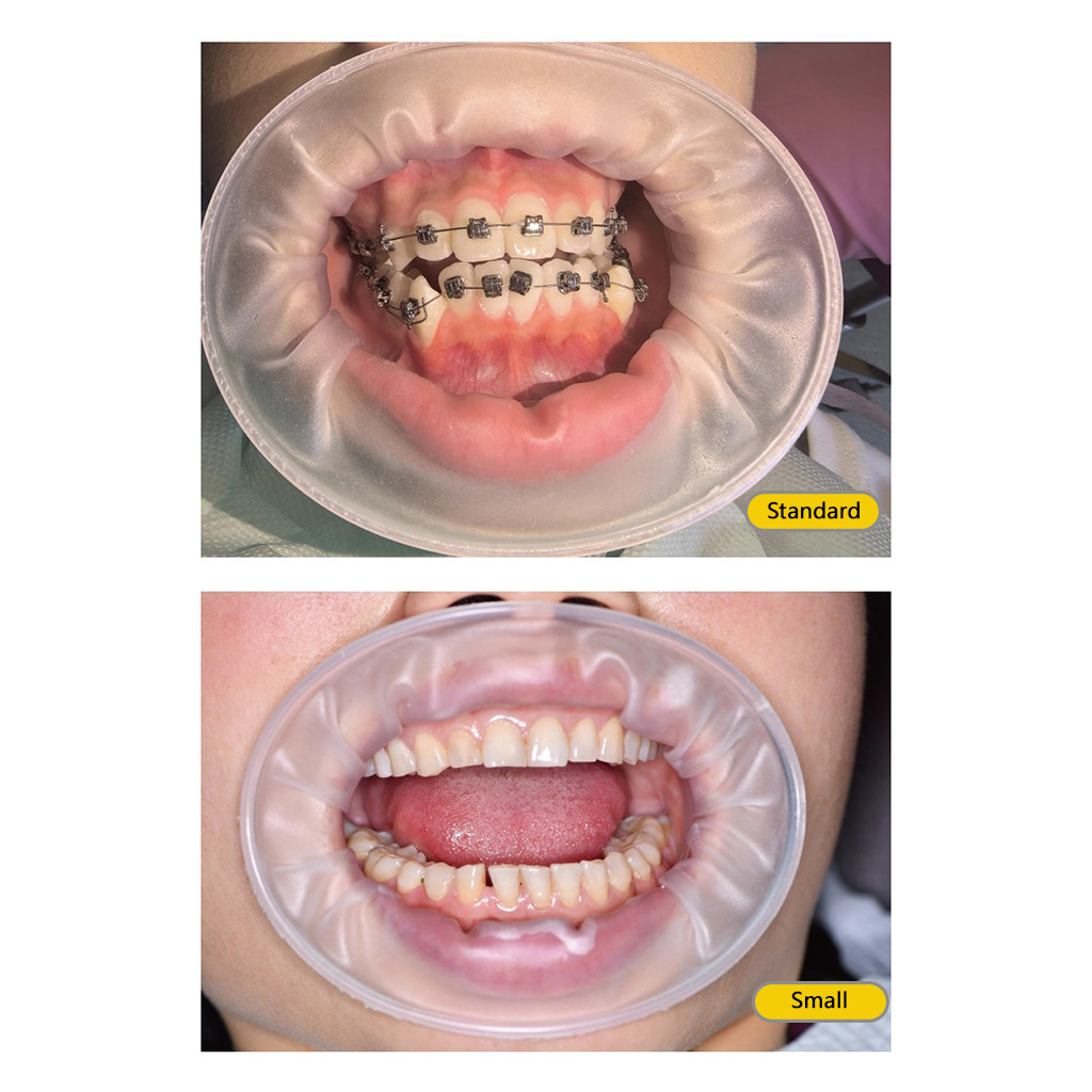口腔 牙医公园开口器 牙科3D三维立体开口器 齿科牙齿美白扩嘴器,美容美体仪器,口腔护理设备礼盒,淘宝优惠券,粉丝福利购,淘宝优惠卷