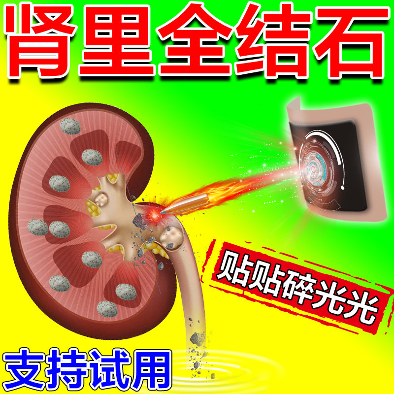 肾结石排石药贴膀胱溶石化石碎石中草膏药血尿肾积水腹痛去除神器
