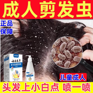 小女孩去剪发虫洗发水成人儿童小白点吃发虫卷发虫头屑止痒喷雾剂
