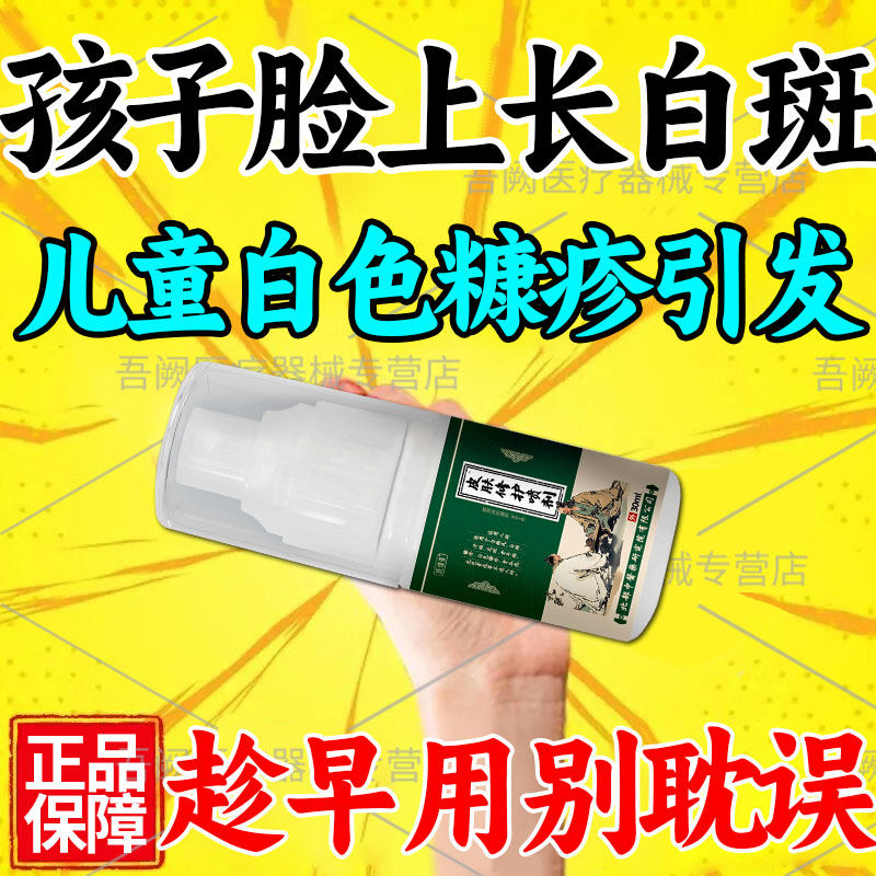 白色糠疹儿童脸上长白斑小孩汗斑桃花癣可搭治疗止痒去癣药膏v5