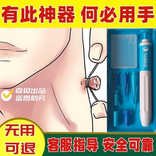 皮赘肉粒去除神器勒猴子疙瘩肉瘤揪球瘊物理祛除工具胶圈神器