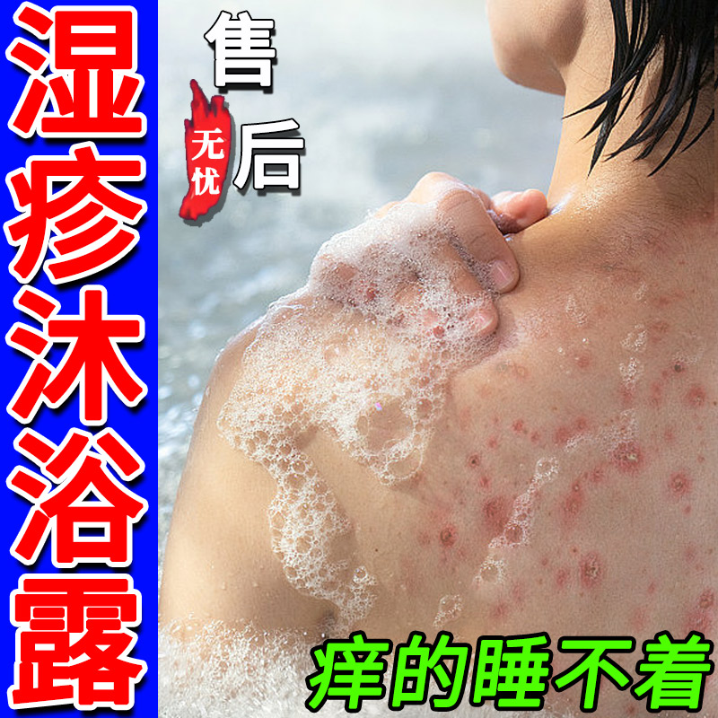 干性湿疹沐浴露角化型手部屁股湿疹慢性股藓止痒成人儿童外用顽固