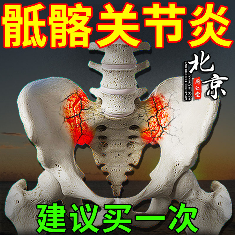北京同仁堂骶髂关节炎膏药热敷