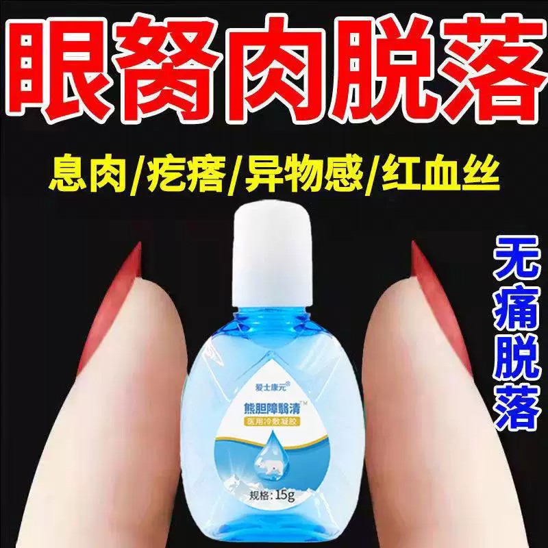 眼睛胬肉滴眼液去除眼睛胬肉翼状眼干眼红异物感疙瘩红血丝护理液