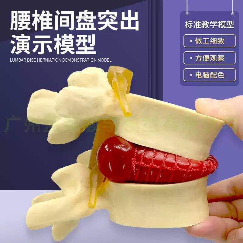 医学人体腰椎间盘受压演示模型 人体脊柱脊椎骨病理侧压突出演示