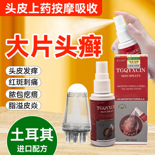 脂溢性皮炎头藓外用抑菌红肿牛皮癣痘真菌感染头皮瘙痒喷剂上药器