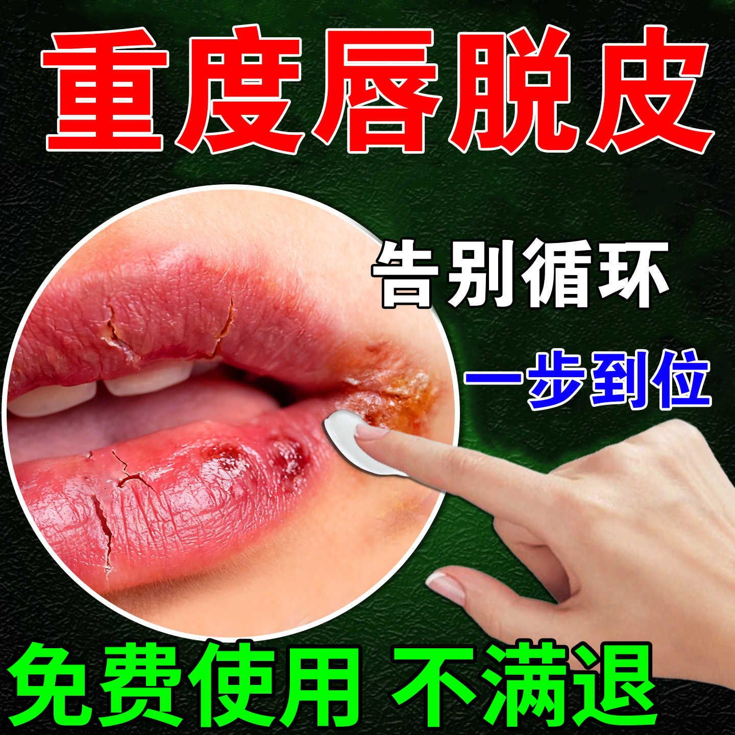 唇炎唇膏嘴唇干裂脱皮专用