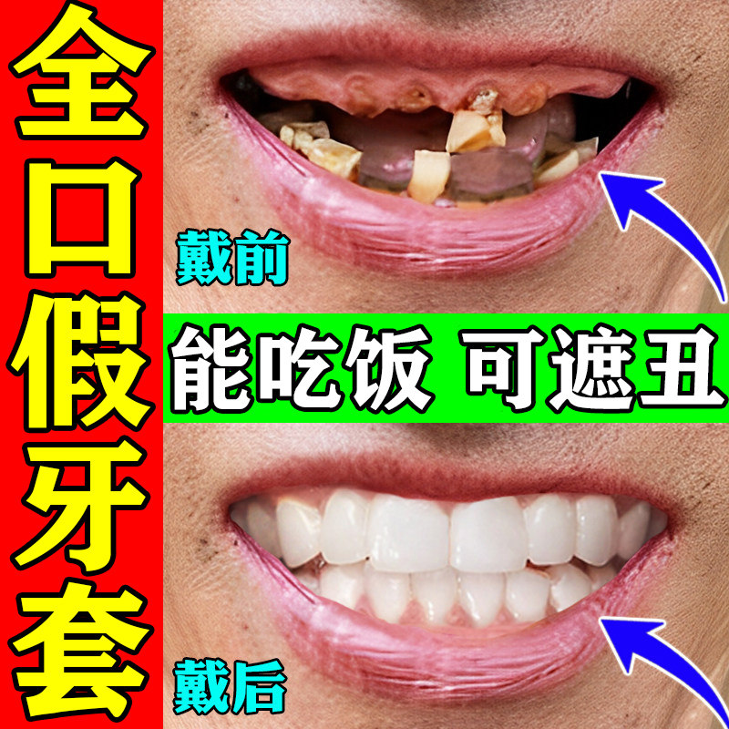 牙套通用吃饭神器成人仿真假牙齿全口门牙永遮丑久专用万老年人能
