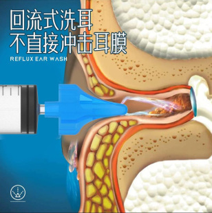 耳朵冲洗器洗耳神器家用耳道上药给药器油耳清洗