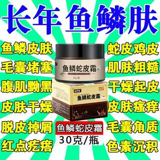 鱼鳞蛇皮霜冬季皮肤干燥痒去鸡皮疙瘩毛囊角质专用药膏身体乳克星