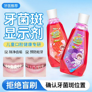 牙菌斑显示剂儿童口腔牙齿牙垢漱口水显色剂神器染色指示剂显色液