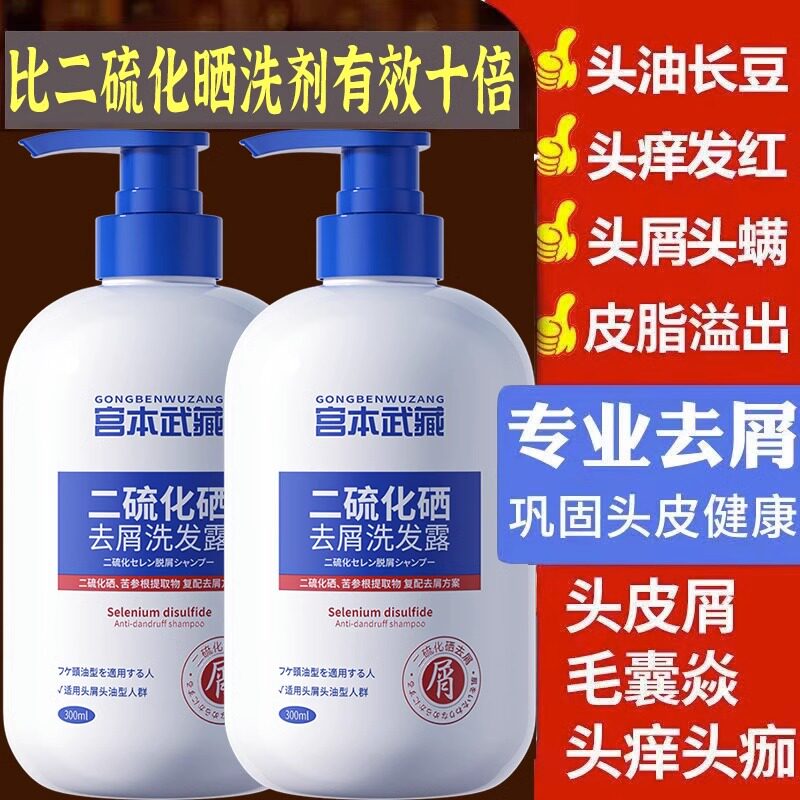 二硫化硒洗发水去屑止痒控油除螨祛痘防脱高性价比高么？
