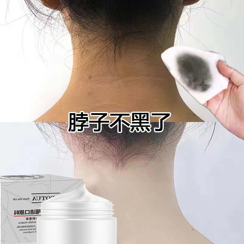 【去脖子黑色素】脖子腋下美白脸部胳膊肘大腿根棘皮男女全身体乳
