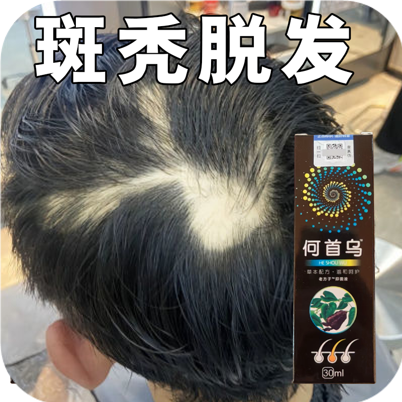 斑秃鬼剃头防专用洗发水儿童成人头发秃一块毛囊受损修复喷雾剂,美发护发/假发,其它护发,淘宝优惠券,粉丝福利购,淘宝优惠卷