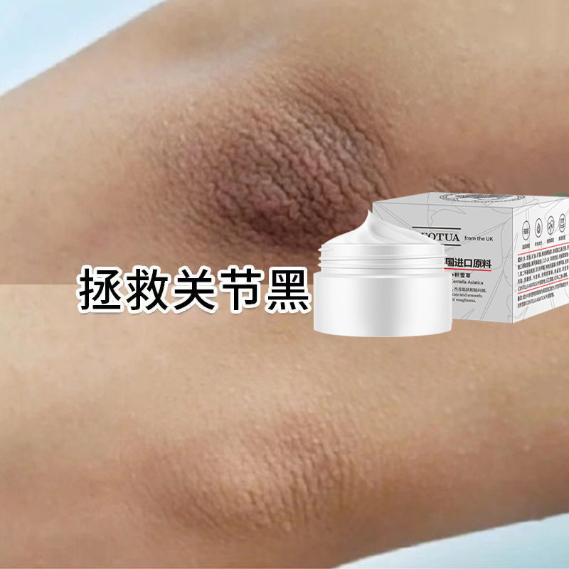 关节去黑淡化黑色素腋下脖子胳膊肘去黑去死皮去角质美白护肤膏
