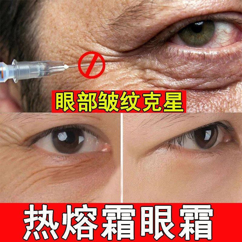 热熔霜紧致抗皱眼霜正品淡化细纹眼袋黑眼圈抗皱提拉肌紧致 先知,彩妆/香水/美妆工具,指甲油,淘宝优惠券,粉丝福利购,淘宝优惠卷