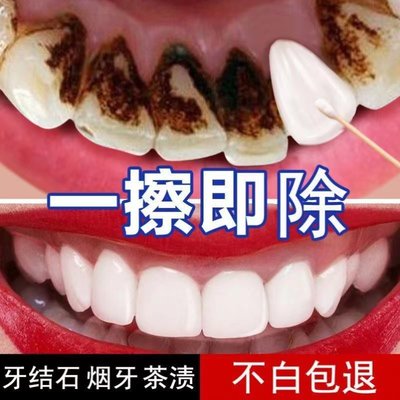 深导白薄荷香美白去渍牙膏去黄口臭牙膏祛黄牙结石牙齿炫白脱色剂