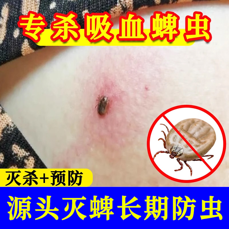 蜱虫杀虫剂蜱虫专用药宠物防虫喷雾杀跳蚤吸血虫家用床上非无毒xf