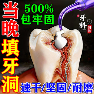 补牙神器自己填充材料医永久用美国进口树脂材料补牙缝牙洞瓷粉b