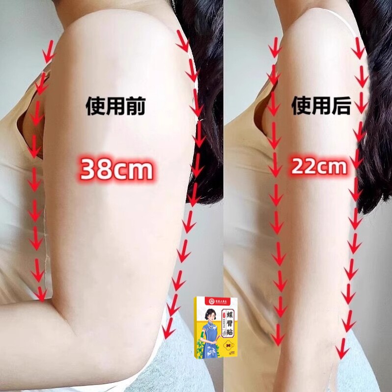 快速去手臂神器大粗胳膊细蝴蝶减拜拜肉女神贴