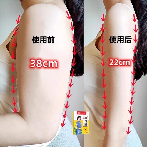 快速去手臂神器大粗胳膊细蝴蝶减拜拜肉女神贴