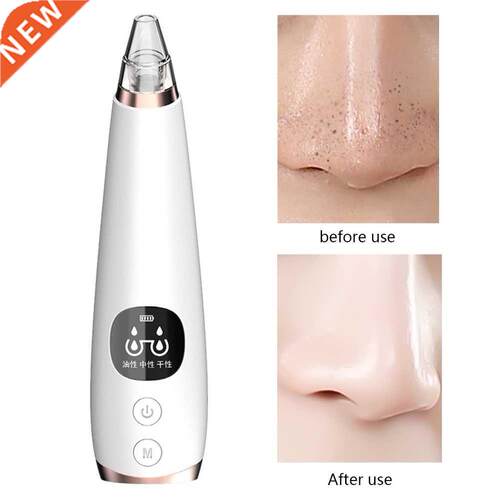 Beauty Instrument Set Extraction Blackhead Remover Equipment