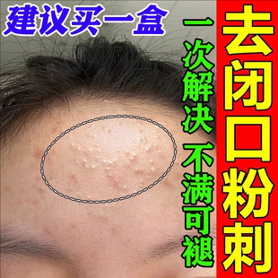 粉刺闭口去除脸部脸上长痘起小痘痘逆光闭合粉刺额头痘粉刺清肤霜