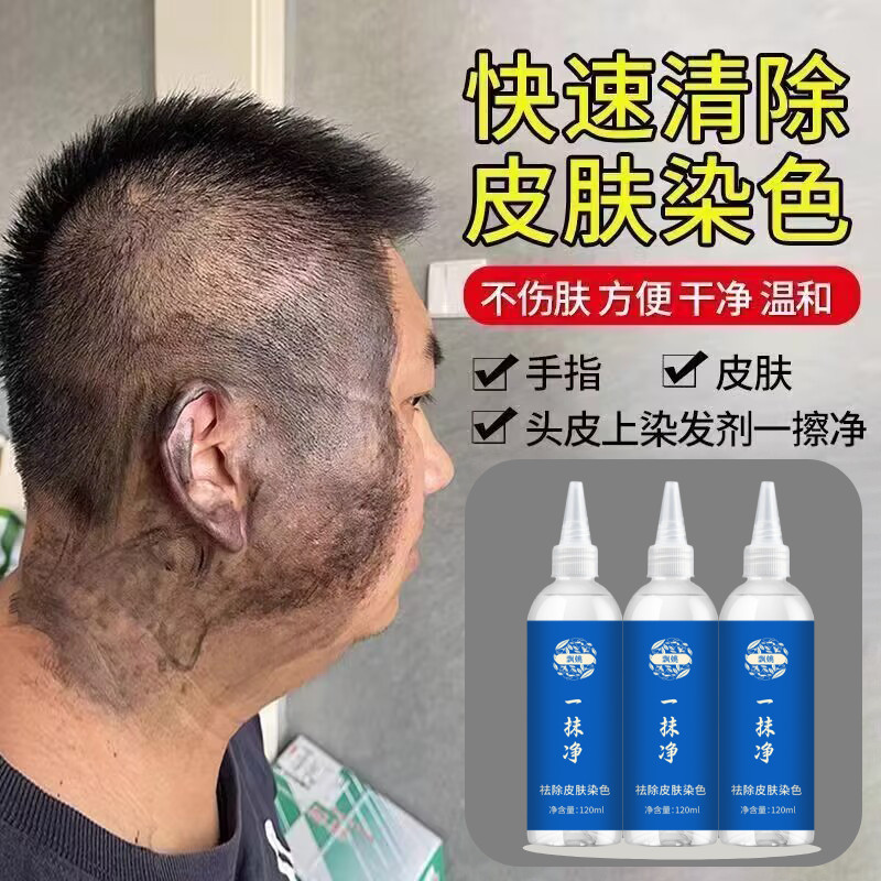 飘姚污渍一擦净去除皮肤上的染发剂祛染发膏头皮清洁清洗专用药水