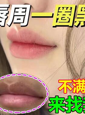 唇周黑改善嘴角暗沉去除黑色素嘴巴周边发黑暗沉唇部护理淡化唇纹