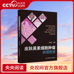 央视网 病理图谱 皮肤黑素细胞肿瘤病理图谱 国内皮肤黑素细胞肿瘤 常建民