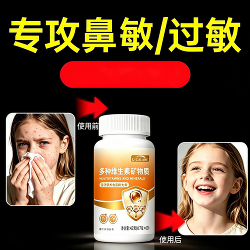 麦司威多维素寻珍麻疹过敏性鼻敏鼻塞痒焱打喷嚏告别敏扰官方正品