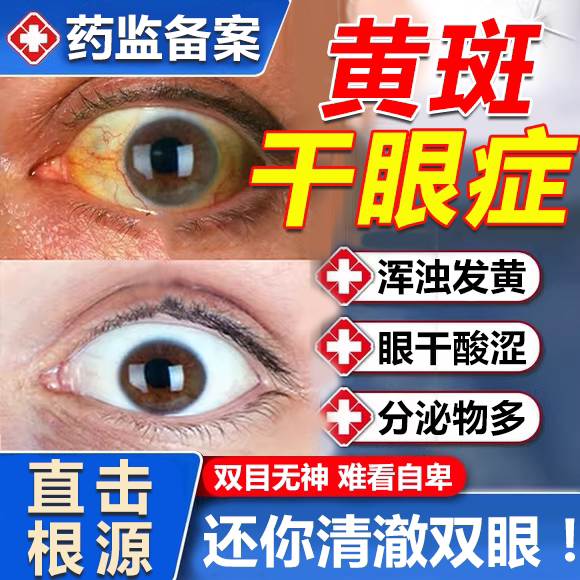 眼白发黄眼睛清澈去黄红血丝浑浊眼底黄斑病变干涩叶黄素眼药水wg