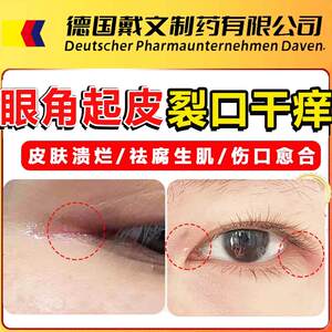 眼角干裂起皮眼痒流泪