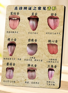 中医养生门店常见舌形舌诊辨证知识科普中式装饰摆件展示牌