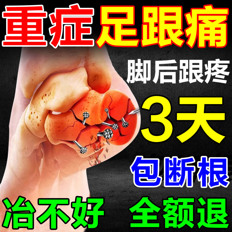 足跟疼痛特效药膏贴足底筋膜炎跟腱炎骨刺治疗脚后跟疼痛专用神器