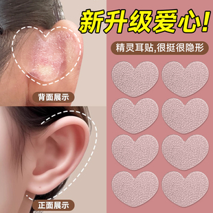 精灵耳贴爱心型支撑强新升级磨砂隐形贴面耳矫正器显脸小无痛立耳