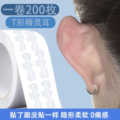 T形龙骨耳贴显脸小定型矫正