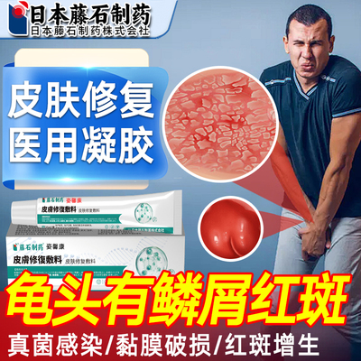 男性龟头炎真菌感染龟头红斑鳞屑红点疙瘩脱皮红斑丘疹增生病hy