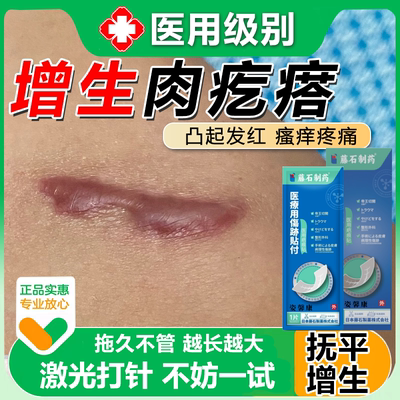 去除疤痕增生硬疙瘩隐形压力贴