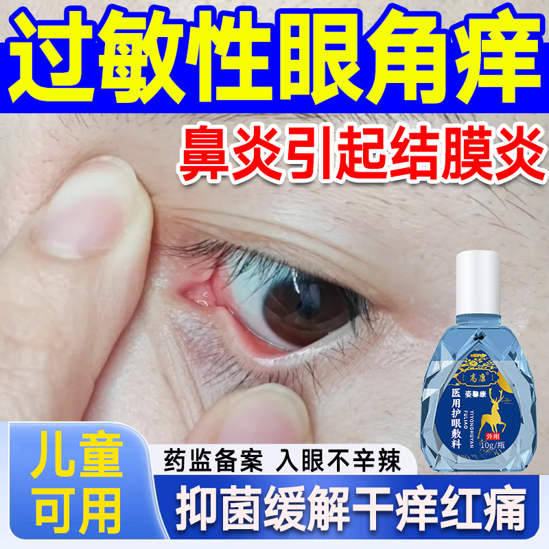 过敏性鼻炎引起眼睛痒儿童滴眼液结膜炎眼角里面痒干涩发痒止痒hy