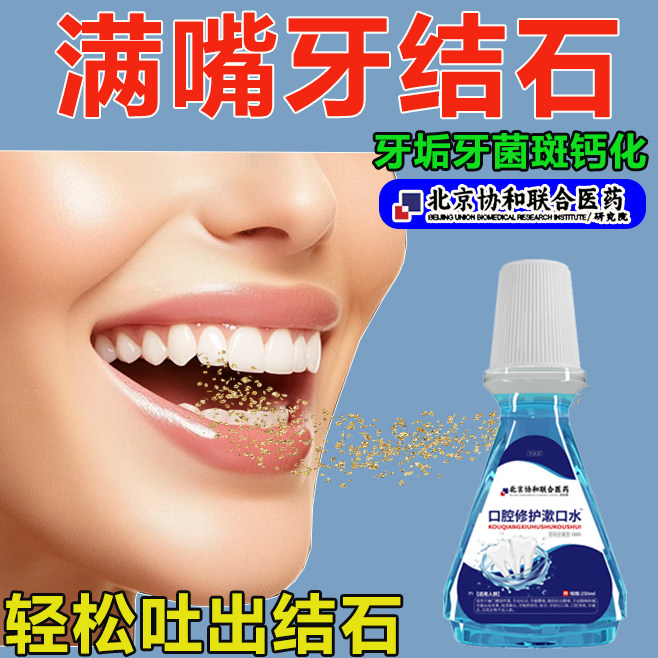 牙结石北京协和漱口水