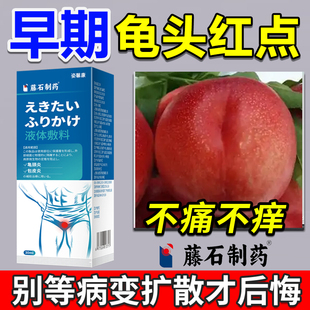 龟头红点不痛不痒发红真菌感染男性炎症龟头上有小红点红肿红斑xj