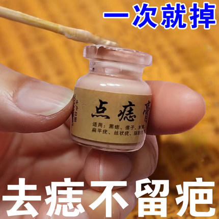 祛痣点痣药膏去痣药水正品不留疤美容院专用点斑痦黑痣子去除神器