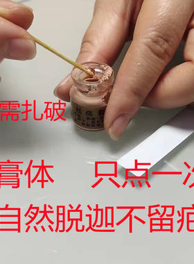 刺去猴除正品点膏痣无痕身体痣